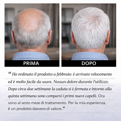 Hairboost® Sistema di Micro-Infusione Capillare per Favorire la Ricrescita dei Capelli