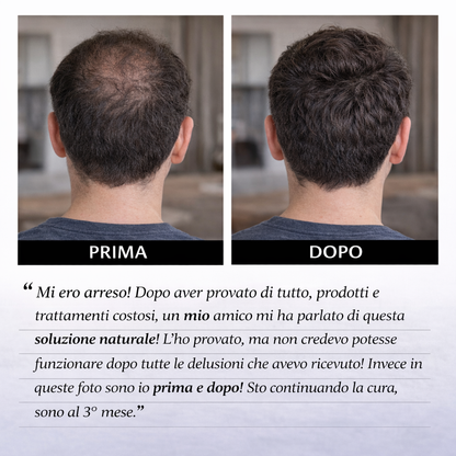 Hairboost® Sistema di Micro-Infusione Capillare per Favorire la Ricrescita dei Capelli
